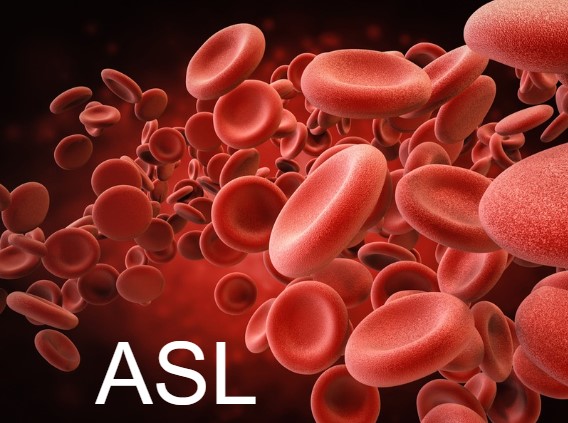 Floating red blood cells with ASL overlay